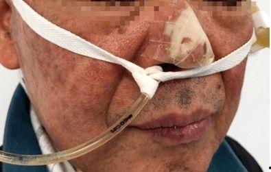 胃管视频,轻松掌握护理技巧