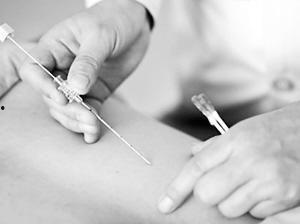 哮喘埋线疗法视频播放,视频解析与传统中医的完美融合